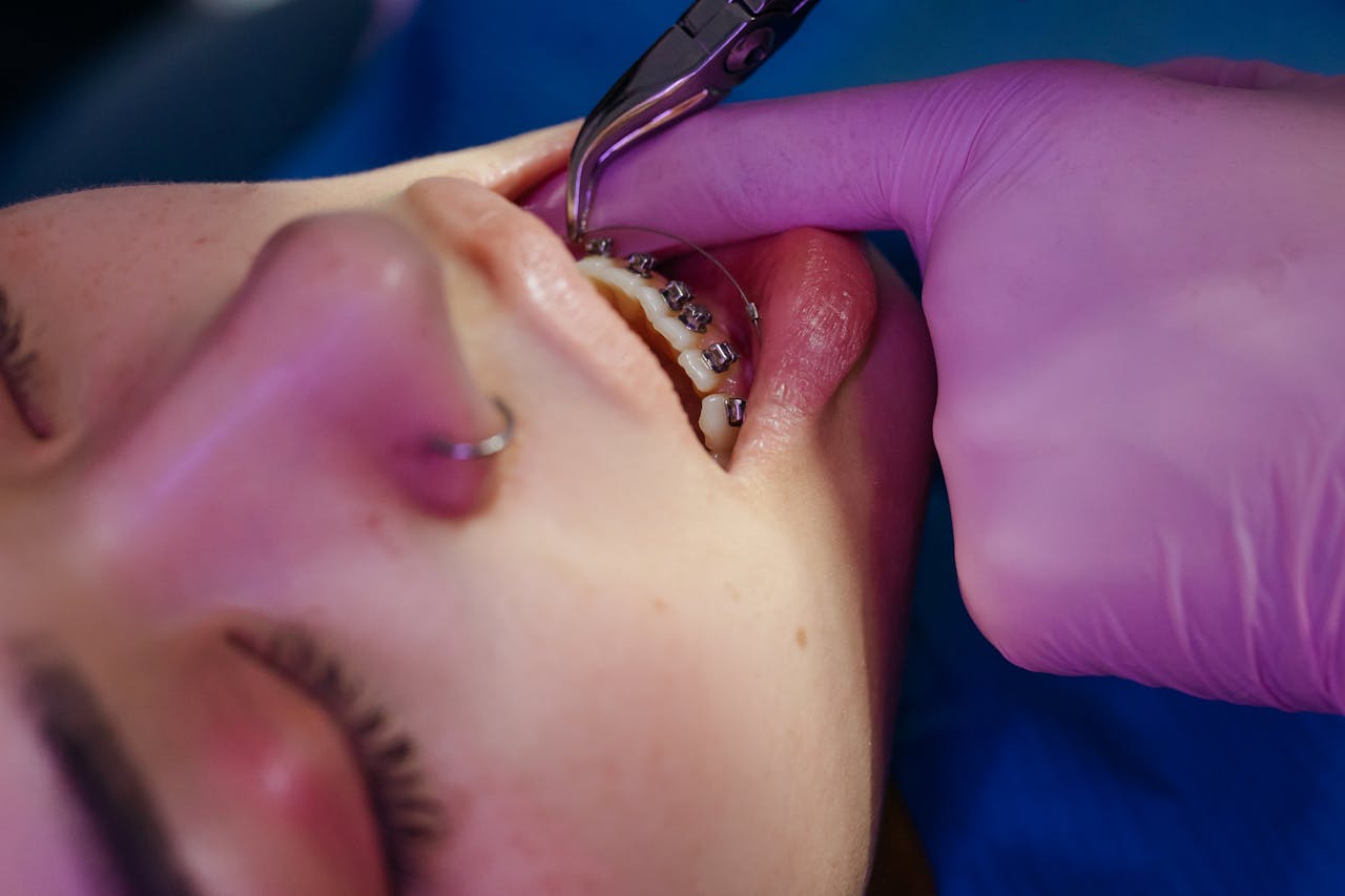 ortodonta na nfz kiedy mozna skorzystac